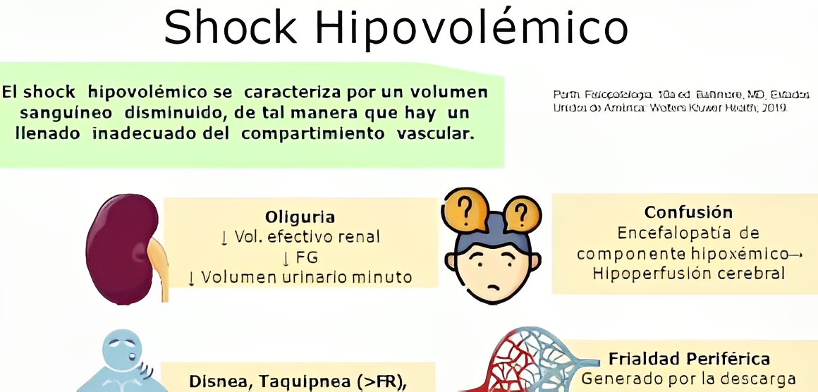 Qu Es El Shock Hipovol Mico Y Cu Les Son Sus Causas Principales